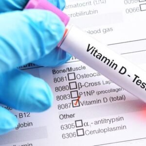 Vitamin D Testing