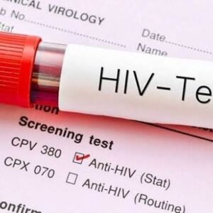 HIV Test (Confidential)