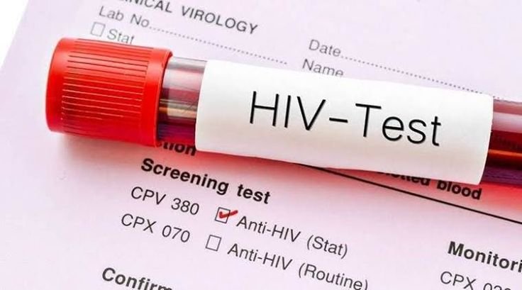 HIV Test (Confidential)