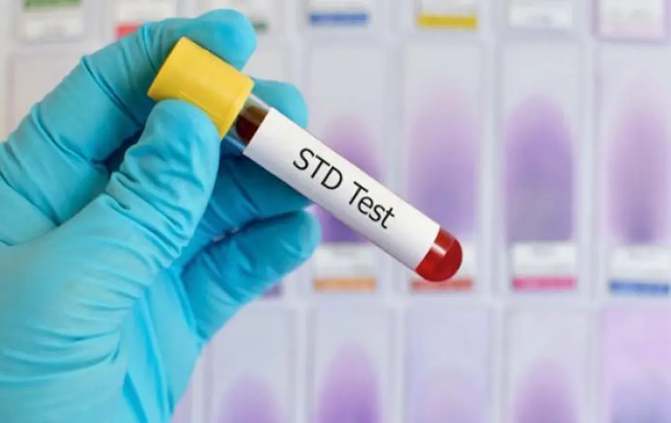 STD 5 Pathogen Test