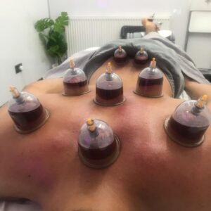 HIJAMA/ WET CUPPING