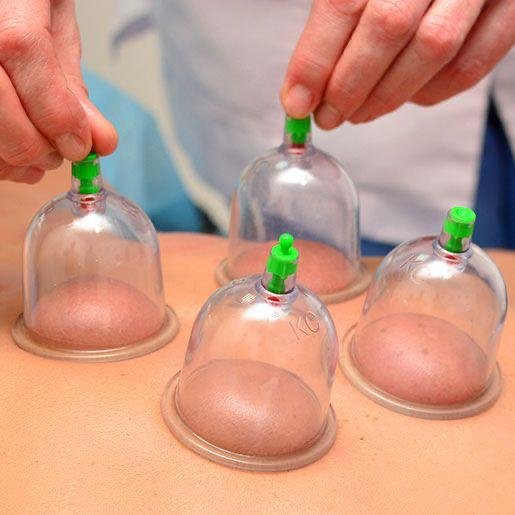 hijama