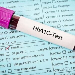 HbA1c Test