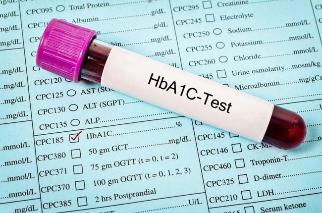 HbA1c Test